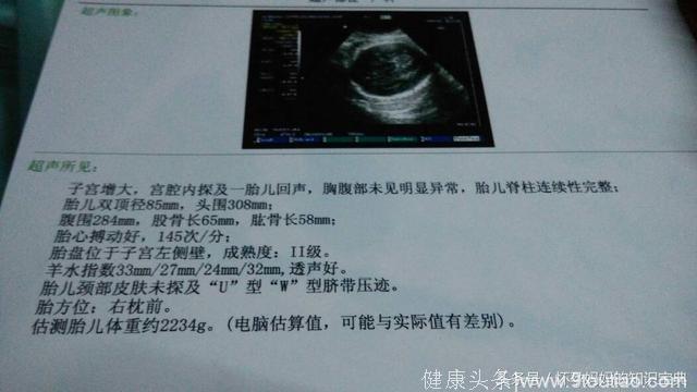 怀孕32周男宝宝肚型 产科生男孩经验分享