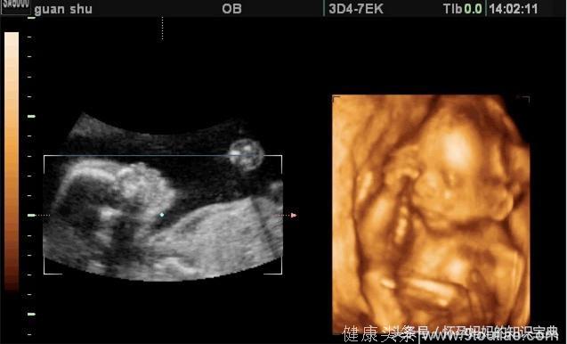 怀孕32周男宝宝肚型 产科生男孩经验分享