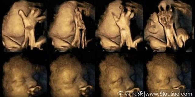 怀孕抽烟对胎儿的危害，用4D照告诉你真相