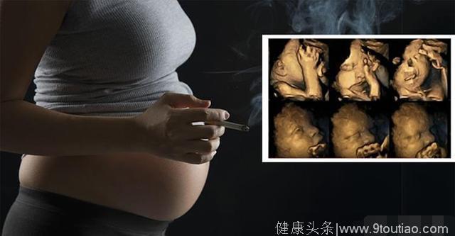 怀孕抽烟对胎儿的危害，用4D照告诉你真相