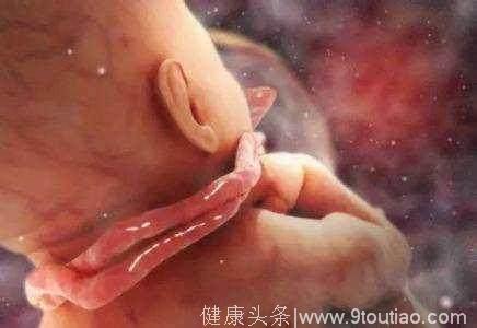 两个方法可观察胎动异常，医生告诉你怎么做才能让孕妈妈尽早发现脐带缠绕！