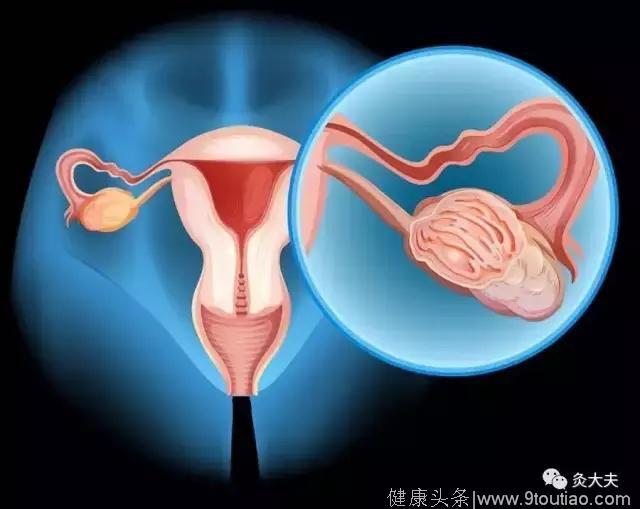 卵巢老一岁，女人老十岁？常按5大穴位，保养卵巢，保鲜女人味！
