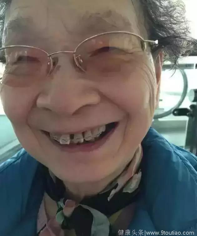 她81岁还在矫正牙齿，你还在犹豫什么？
