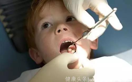 这些儿童牙齿矫正攻略，你知道多少？