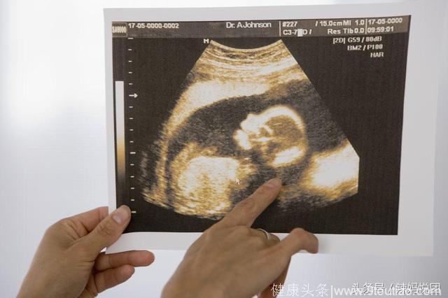 孕期B超检查会伤害宝宝吗？B超看宝宝性别准确吗？B超什么都能检查到吗？有疑问的都来看看