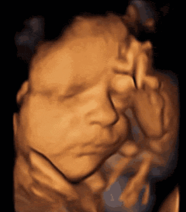 孕期B超检查会伤害宝宝吗？B超看宝宝性别准确吗？B超什么都能检查到吗？有疑问的都来看看