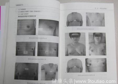 中华乳腺癌防治协会权威发布《乳腺病新疗法》