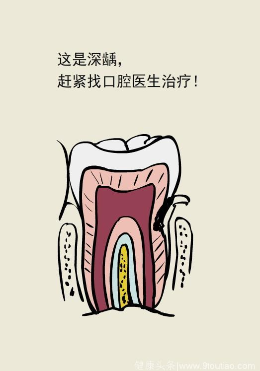 牙疼起来要命，吃什么药救命？