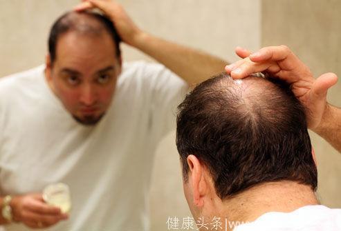 你是什么原因导致的脱发？该怎么治疗最好？