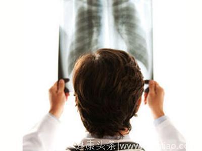 得了肺癌还能活多久？