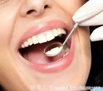 牙齿修复，修复类型及特点