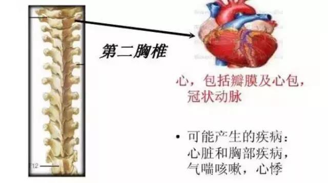 详细图解脊椎（颈椎、胸椎、腰椎）可能引起的108种疾病，太全面了，强烈建议收藏