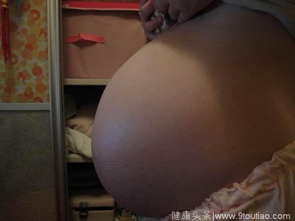 23岁孕妇怀上四胞胎，却被医生要求减去两胎，孩子出生后全家乐坏了