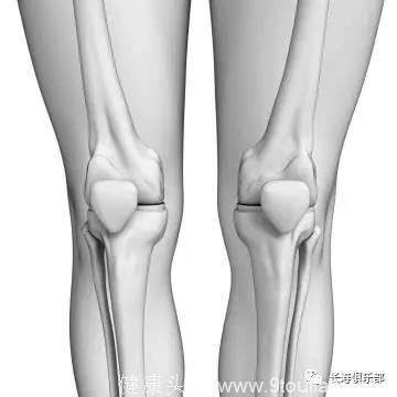 中老年人膝疼应警惕患有骨性关节炎