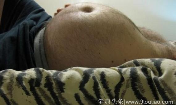 30岁小伙肚子大如孕妇，医生说再晚来1个月，就没他了