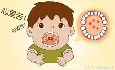 炎炎夏季，宝宝看起来像感冒，其实是疱疹性咽峡炎！
