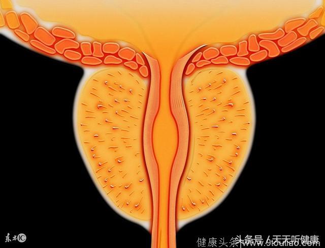 男人的前列腺为啥老是出问题？专家告你可以这样治