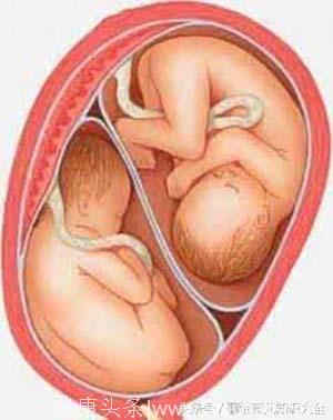 25岁孕妇早产生下四胞胎，看到孩子的性别后，全家人却高兴不起来