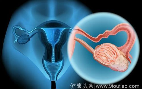 每1小时有3名女性死于宫颈癌！内地首个宫颈癌疫苗你打不打？