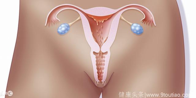 子宫下垂的主要问题是什么