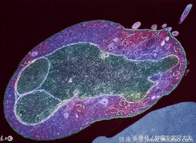 肠道菌群是潜在的“生物标志物”，可预测癌症对免疫疗法的疗效