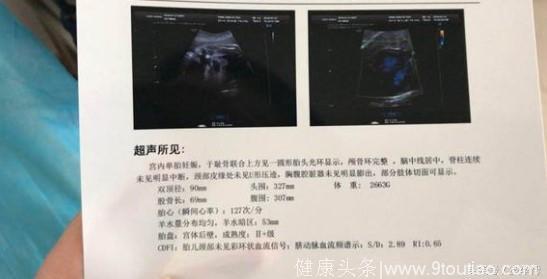 妇产科医生亲述：孕期抽血次数太多，宝宝37周发现发育太小，危险