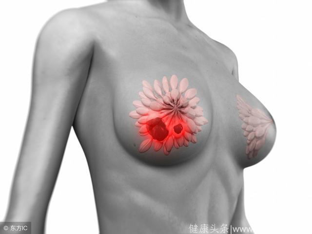 为什么把乳房切掉了还是会出现乳腺癌复发？