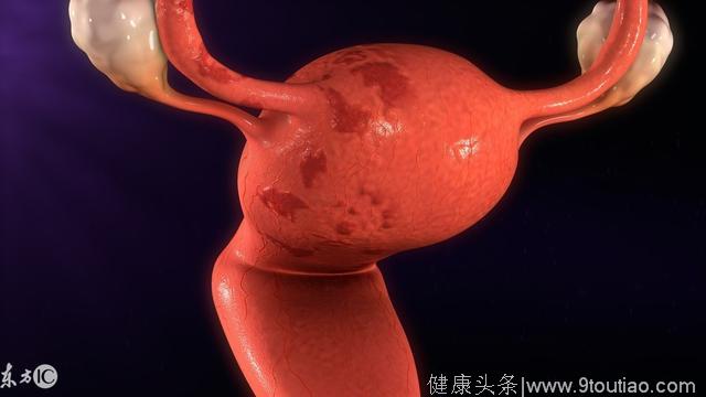 子宫内膜增生的症状体征与病理特点