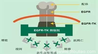 III期临床试验后适用于中国患者的非小细胞肺癌新靶向药