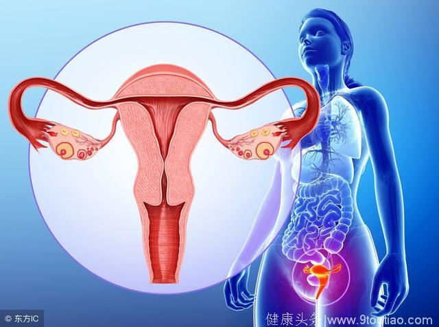 子宫肌瘤主要有“6大”临床症状