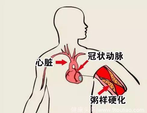 「健康」45岁以上？胸闷心痛？远离油腻才能人生开挂！