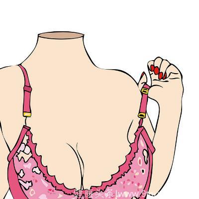 乳头内陷是乳腺癌吗不同病症但有牵连