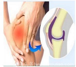 十人膝八个关节炎，其实可以使用这个方法，膝盖慢慢就好起来了