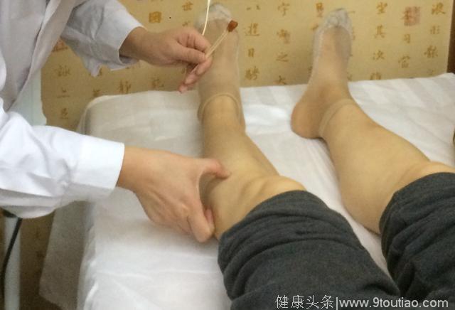 “请收下我的膝盖” 温针为什么被称为膝关节冷痛的克星