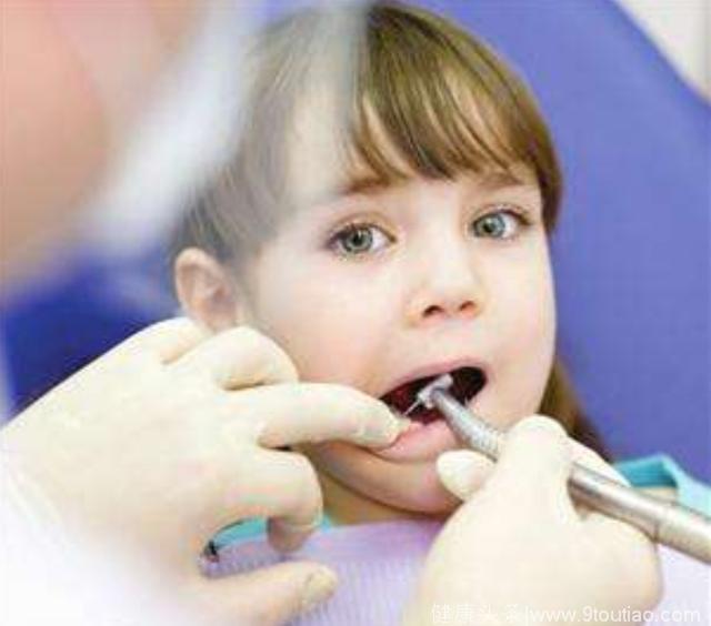 美国牙医协会，对儿童牙齿健康测试