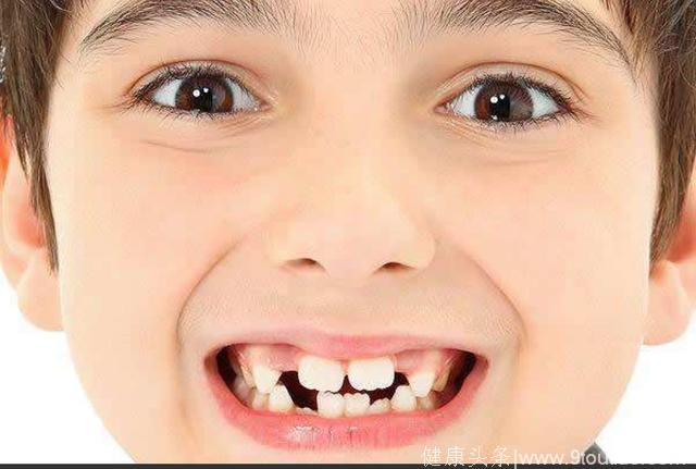美国牙医协会，对儿童牙齿健康测试