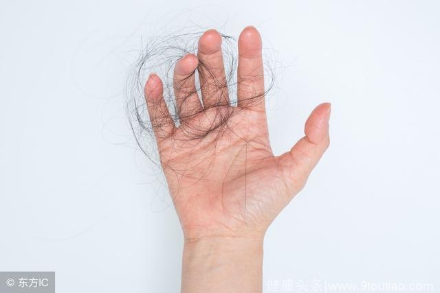 是什么原因导致的女性脱发呢