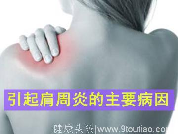 引起肩周炎的主要病因有什么
