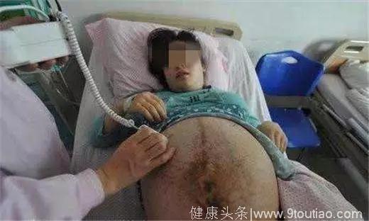 35岁孕妇怀胎7月，检查有畸形不忍打掉，孩子出生后孕妇大哭