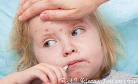 宝宝发热还出疹子！是幼儿急疹？水痘？还是手足口？