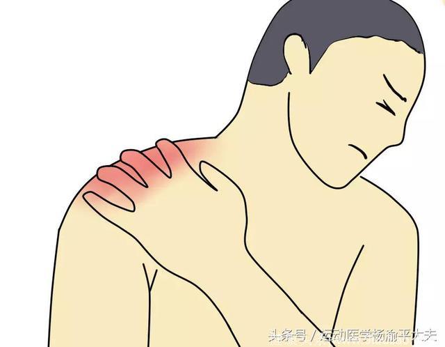 肩疼不明就里，原来这是肩周炎的典型表现
