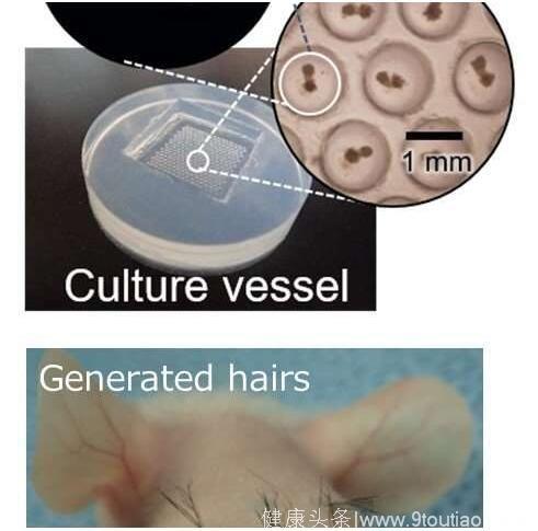 Biomaterials：脱发人士福利！科学家开发出头发快速再生新技术
