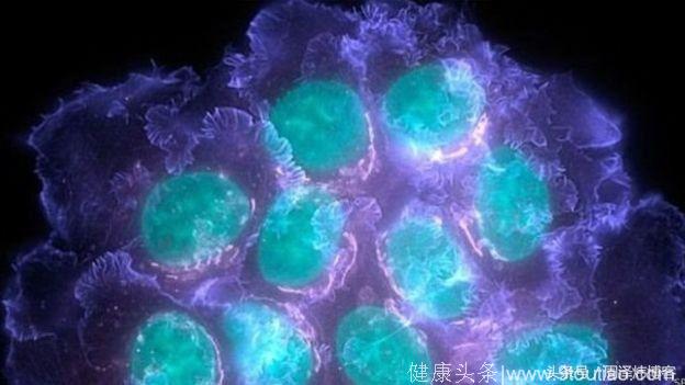 “饿死”癌细胞或许开启未来癌症治疗新篇章
