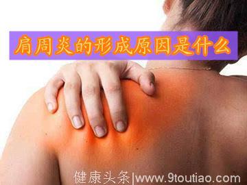 肩周炎的形成原因是什么
