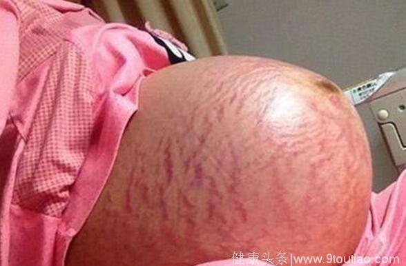 48岁孕妈产检得知怀的是龙凤胎，可宝宝生下后，她却哭成泪人
