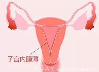 当心！子宫内膜太薄可能影响你的好孕