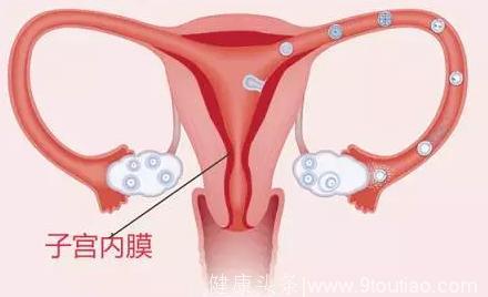 当心！子宫内膜太薄可能影响你的好孕
