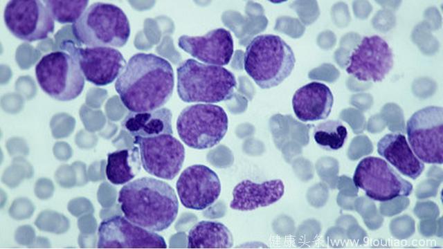 疟疾能治疗癌症？穗科学家公布癌症免疫疗法重大科研成果