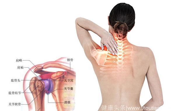 肩膀疼痛≠肩周炎，肩周炎的治疗方法
