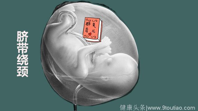 孕期经常抚摸肚子会导致胎儿脐带绕颈？为了“好孕”要注意什么？